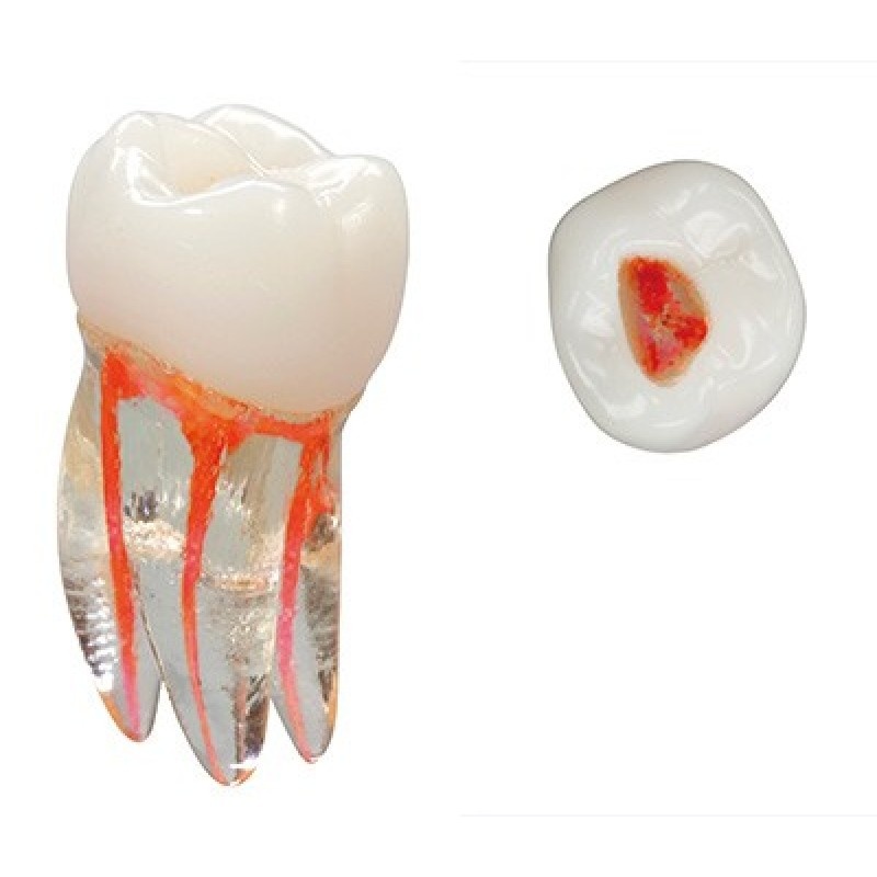 Зуб тренировочный пластиковый для эндодонтических тренировок (1 шт.)