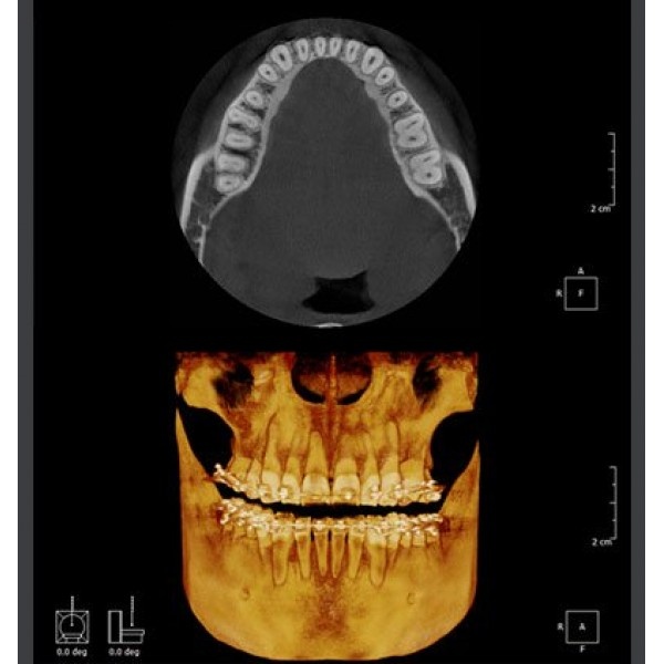 RAYSCAN Symphony a М3DS – томограф 3 в 1: ортопантомограф и цефалостат (OneShot) 30х25 см, компьютерный томограф 3D 9х9 см