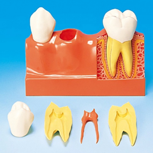 Модель трех верхних зубов с разделением эмали, дентина и пульпы
